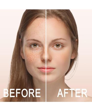 2024 Niacinamide 10% + Zinc 1% Serum for Acne & Oil Control | Refreshing Facial Serum with Roller - Buy Online on GoSupps.com