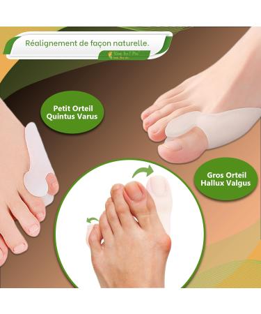 Slim Feet Pro Set: 2 Pairs of Hallux Valgus & Toe Spreaders for Pain Relief Protection & Comfort - Buy Online on GoSupps.com