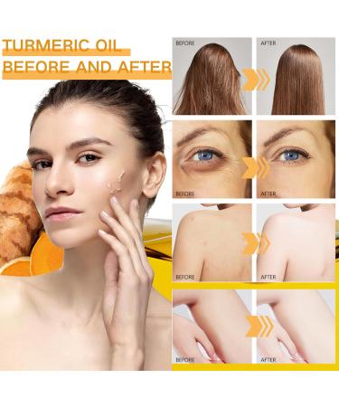 Turmeric Oil - Natural Turmeric Body Oil for Women - Hydrating Skin&Face&Body Oil 100ml - Turmeric Essential Oils for Skin Rapair Reduce Dark Spot Bright Nourish - Buy Online on GoSupps.com