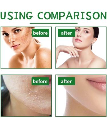 Yeast Ointment Yeast Ointment with the plus of Aloe Vera and Ginkgo Biloba Yeast Body Peeling Premium Quality for Rubbing Skin and Dry Skin Yeast Ointment for Women and Men (200ml 2pc) - Buy Online on GoSupps.com