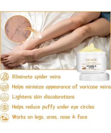 2023 New Varicose Veins Miracle Cream - Natural Treatment for Legs (2 Pack) | International Shipping Available - Buy Online on GoSupps.com