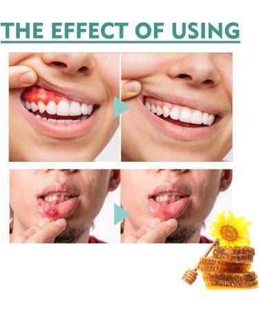 Toothache Relieving Spray Oral Care Spray Tooth Pain Relief Gum Pain Spray Toothache Relief Dental Pain Relief Pain Spray for Tooth Ache Instant Teeth Treatment Relief Strong Pain Relief for Toothache - Buy Online on GoSupps.com