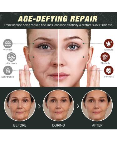 CFXYHNOX Beef Tallow for Skin & Face Cream with Castor Oil and Frankincense Natural 100% Grass Fed Whipped Beef Tallow Balm Deeply Moisturizing for Face & Body Care 4.2 oz - Buy Online on GoSupps.com