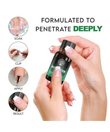 Extra Strength Toenail Fungus Treatment - Antifungal Nail Solution for Athletes Foot & Fungal Nail Infections - Buy Online on GoSupps.com