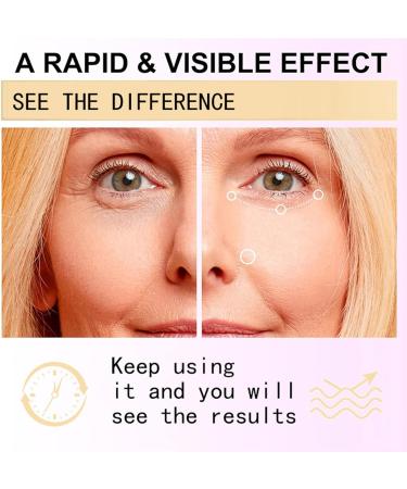 Eye Cream for Dark Circles and Puffy Eyes - Snail Peptide Energetic Eye Roll-On - Eye Bags Remover Eye Cream Anti aging - Under Eye Roller cream - Reduce Lines Wrinkles Puffiness and Dark Circles (1) - Buy Online on GoSupps.com