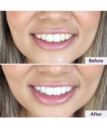 Smirk Teeth Brightening Powder 40g - Natural Whitening Formula | Shop Now - Buy Online on GoSupps.com