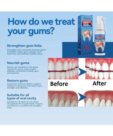 Toothache Relieving Spray Toothache Pain Relief for Adult Oral Care Spray for Toothache Tooth Pain Spray for Toothache Relief Dental Pain Relief Spray for Gum Health Sore Gums Treatment Pain Spray - Buy Online on GoSupps.com