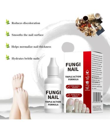 Toenail Fungus Treatment Overnight Long Lasting Nail Treatment for Athletes Foot Thick Broken Discolored and Damaged Nails 15 Ml05 Oz 1 pcs - Buy Online on GoSupps.com