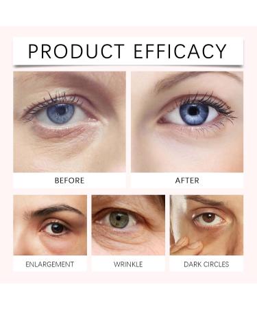 Retinol Eye Cream for Dark Circles Anti-Aging Moisturizing Treatment for Under Eye Area Fight Fine Lines Wrinkles & Dark Spots 0.71 oz - Buy Online on GoSupps.com
