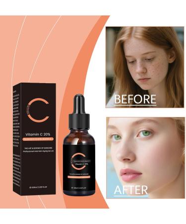 YNPQTDS Face cream Facial Hydration Solution 100ml Facial Nourishing Cream for Nighttime Mixed Sensitive Oily Skin Daily Routine - Buy Online on GoSupps.com