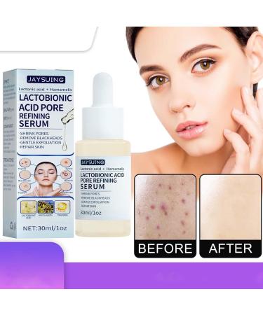 Young lactobionic acid hydrating lactobionic acid 30ml lactobionic acid active skin always young repairs fine pores for thirsty skin - Buy Online on GoSupps.com