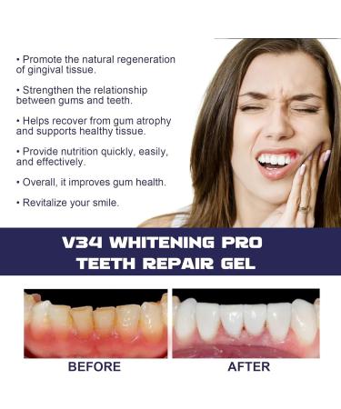 KOAHDE Dental Gel Pen Gum Repair Gel Pen Dentizen Gum Therapy Gel Gum Shield Therapy Gel Gum Pen Dental Rinse Gum Regrowth Gel Pen Deep Cleans Teeth Gel Pen Gingivaease Gum Pen Gel 4ML 1PC - Buy Online on GoSupps.com