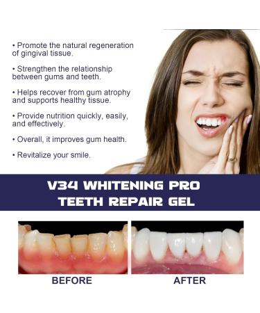 Koahde Dentizen Gum Therapy Gel - Sensitive Teeth Relief Gentle Gum Repair & Teeth Whitening Essence Pen - Buy Online on GoSupps.com