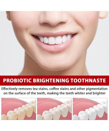 SP-6 Ultra Whitening Toothpaste 2PCS Probiotic Brightening Formula | Fresh Breath & Deep Cleaning | International Shipping - Buy Online on GoSupps.com