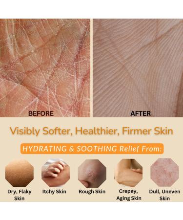 Orange & Vanilla Fusion Hand & Body Lotion, Natural Moisturizer for Dry Skin w/Aloe Vera, Coconut Oil, Ceramides, Vitamin B5, Vitamin E, Intense Moisturizing Cream 8 oz Orange & Vanilla 8 Fl Oz (Pack of 1) - Buy Online on GoSupps.com