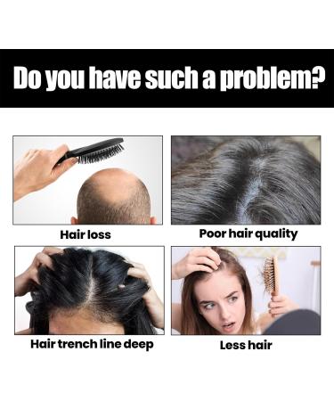 Rosemary Oil For Hair Growth Castor Oil Organic & Argan Oil For Hair Tea Tree Oil For Hair Improve Hair Loss & Strengthen Hair Promote Hair Growth & Nourishes Scalp Hair Care - Buy Online on GoSupps.com