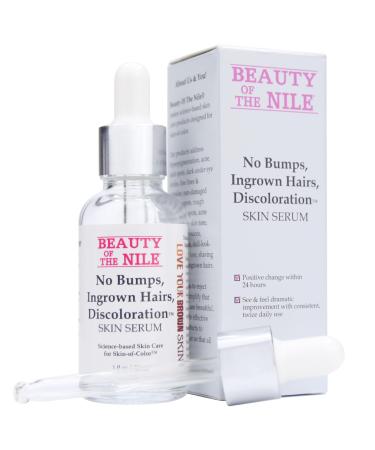 No Bumps Ingrown Hairs Discoloration Serum for Skin-of-Color Eliminates Shaving Bumps Razor Burn Dark Spots Ingrown Hair - Head Face Bikini Beauty of the Nile 1 oz