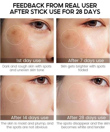 Vitamin C Face Cream Moisturiser Anti Wrinkle Anti Aging Cream With Hyaluronic Acid & Vitamin E Day & Night Cream For Women And Men Brightening Hydrate Restore&Boost Collagen 30g - Buy Online on GoSupps.com