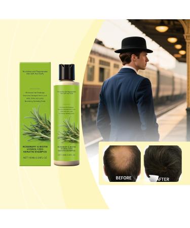  Generisch Rosemary hair growth shampoo for women and men organic hair growth shampoo with hydrolyzed keratin anti-hair loss repairing and nourishing scalp treatment - Buy Online on GoSupps.com