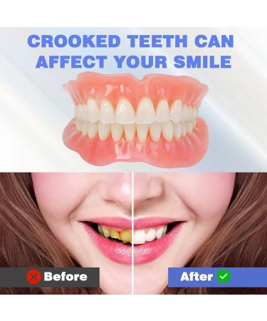 DIY denture kit with dental wax for making partial and full dentures at home equipped with tools and temporary teeth - Buy Online on GoSupps.com