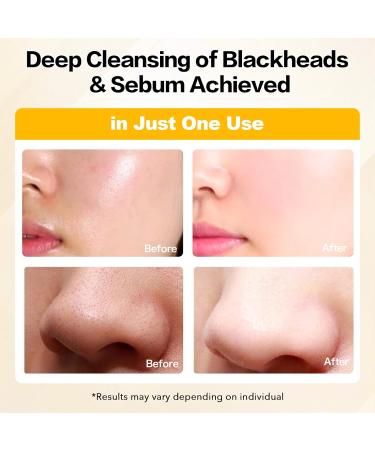 NAILKISS Cleansing Oil for Face 200ml - Plant-Based Makeup Remover & Blackhead Cleanser - Lightweight Pore Control for Sensitive Skin - Buy Online on GoSupps.com