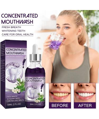 Concentrated Mint Mouthwash - Fresh Breath & Whiter Teeth | 59ml for Men & Women - Eliminate Bad Breath - Buy Online on GoSupps.com