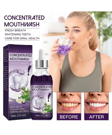 Concentrated Mint Mouthwash for Fresh Breath Plaque Removal & Teeth Whitening - 59ml | International Shipping - Buy Online on GoSupps.com