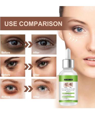 Eye Serum For Firm Skin & Tight Around Eye Eye Serum For Dark Circles & Puffy Eyes Bags Under Eyes Treatment For Women & Men Anti Wrinkle & Anti Aging Eye Serum Reduce Fine Lines - Buy Online on GoSupps.com