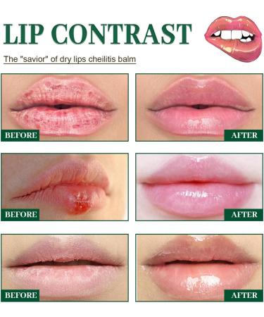 Mouth Ulcer Treatment Spray Mouth Ulcer Treatment for Adults Canker Sore Treatment Oral Care Spray Herbal Mouth Spray Canker Sores Relief Spray for Mouth Ulcer Bad Breath Treatment Mouth Freshener - Buy Online on GoSupps.com