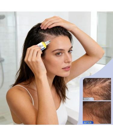 Hair Growth for Women 30ml Hair Oil Roll-On - Natural Hair Thickening and Growth | For Frizz Follicle Slimming Men's Health Seniors Home Travel - Buy Online on GoSupps.com