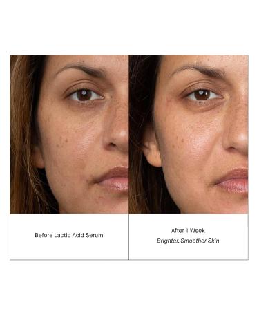 SHANI DARDEN Lactic Acid Face Serum Travel Size - Brightening PM Serum 0.34 fl oz - Buy Online on GoSupps.com