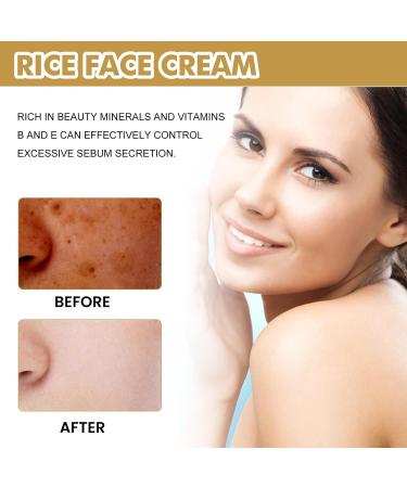 PEYNIR 1/2/3/5pcs 2024 new crema de arroz para blanquear la piel crema para las manchas de la cara Cremas para Las Manchas de La Cara Oscuras crema de arroz para la cara blanquear (2pcs 15ml) - Buy Online on GoSupps.com