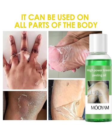 Extra Strength Peeling Oil for Dark Skin - 110ML | Chemical Peel for Face Hands & Feet - At Home Treatment - Buy Online on GoSupps.com