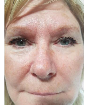Eyesential 20ml Bottle: Removes Wrinkles, Puffiness, Dark Circles - Back in Stock - Buy Online on GoSupps.com