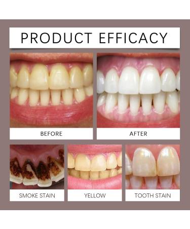 Daily Care Cleaning Toothpaste - Gentle Stain/Tartar Removal Freshens Breath Brightens Teeth Supports Oral Hygiene(1PCS) 1 Fl Oz (Pack of 1) - Buy Online on GoSupps.com