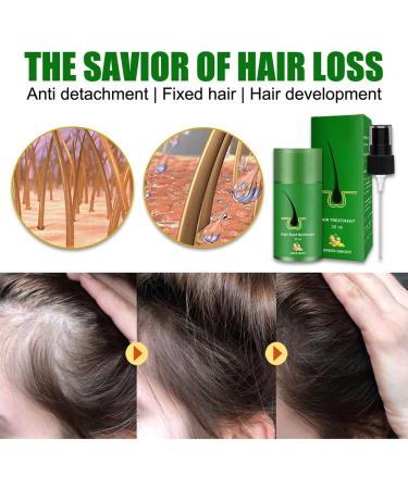 Hair Growth Serum - Anti-Hair Loss Treatment for Thinner Hair | Thickening & Re-Growing Solution (1 PC) - Buy Online on GoSupps.com