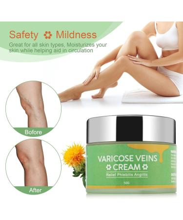 EXQST Varicose Veins Cream CremePure Varicose Veins Leg Cream - Buy Online on GoSupps.com