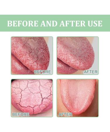 Canada Polumna Fissured Tongue Relief Spray | Fresh Breath & Oral Health Treatment (2PCs) - Ideal for All - Buy Online on GoSupps.com