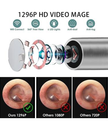 Wireless Ear Wax Removal Tool with Camera and LED Lights - 1296P Ear Cleaner for i-Phone, iPad, Android - Includes 12 Ear Tips - Buy Online on GoSupps.com