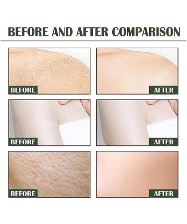 Aloe vera scrub aloe vera body scrub exfoliating gel to remove dead skin exfoliating scrub for all skin - Buy Online on GoSupps.com