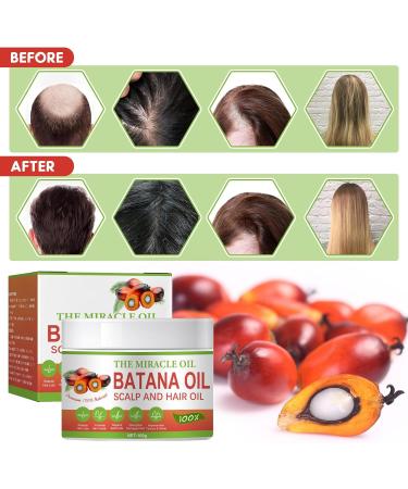 INBOLM Batana Oil Raw Batana Oil Batana Oil For Hair Growth Batana Oil Organic 100% Natural Batana Oil from Repairs Damaged Hair Skin Reduces Hair LossMiracle Oil for Healthier Thicker Fuller 100ml - Buy Online on GoSupps.com