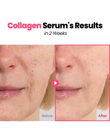 GLAM UP Plump Nourishing Marine Collagen Serum | Anti-Aging Skincare with Hyaluronic Acid & Peptides | 30ml  - Buy Online on GoSupps.com