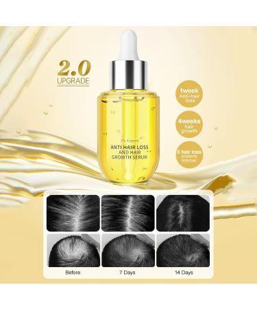 Return Ginger oil for hair Ginger Regrowth Oil Hair Serums50 ml Hair Serums Oil Prevention of hair loss and natural serums for thicker stronger and longer hair Men and women Retorno - Buy Online on GoSupps.com