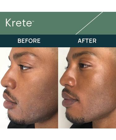 KRETE Hydrating Facial Serum for Men - Moisturize Smooth Hydrate & Protect Your Skin In 30-Seconds Oil-Free All Skin Types with Apple Stem Cell Extract & Hyaluronic Acid - 1 Fl Oz (Pack of 6) - Buy Online on GoSupps.com