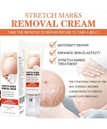 Remove Stretch Marks Cream | Body Repair Cream with Centella Glycerol for Women | Post-Pregnancy Stretch Mark Reduction | 45g - Buy Online on GoSupps.com