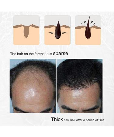 Hongjingda Rosemary Black Cumin Oil 30 ml Black Cumin Hair Growth Mist Natural Hair Growth for Damaged and Weak Hair Fermented Rice for All Hair Types - Buy Online on GoSupps.com