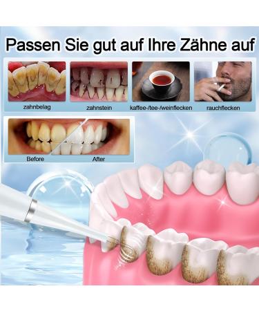 LAMJAD Tartar Remover - Effective White Teeth Cleaning Tool (1 Piece) for Sparkling Smiles - Ships Internationally - Buy Online on GoSupps.com