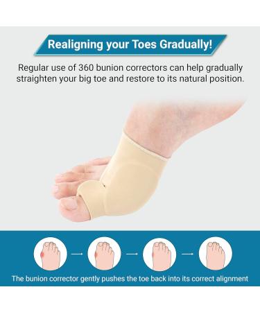 360 RELIEF Silicone Bunion Corrector - Big Toe Separator & Pain Relief | Beige Large Pair + Mesh Laundry Bag - Buy Online on GoSupps.com