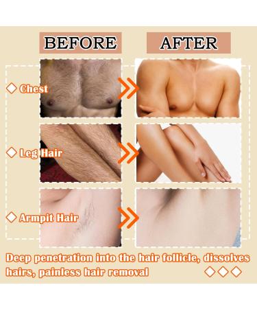 Moisturizing Long-Lasting Flawless Hair Removal Cream | Gentle Depilatory for Men & Women | All Skin Types | International Shipping Available - Buy Online on GoSupps.com