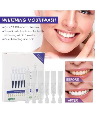 Mouthwash for Fresh Breath & Teeth Whitening | Effective Travel Mouthwash - Buy Online on GoSupps.com